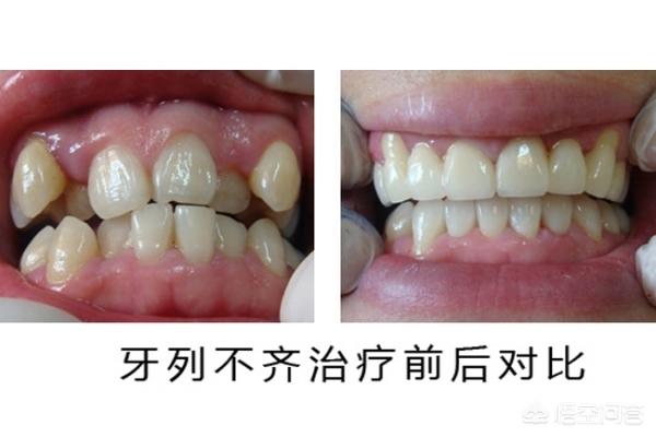 昌都最新24小时牙医在线咨询方法分析(最方便真实的昌都有没有24小时牙医方法)